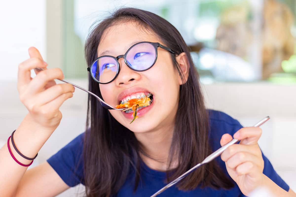 braces archwired dentari ganci mangia morde biting asiatica gode giapponese gelato ragazza cintas morder femininas ligado