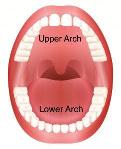 Two_Arches