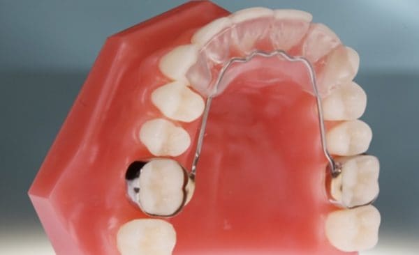 What Is A Bite Plate In Orthodontics Archwired