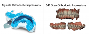 Orthodontic_Impressions