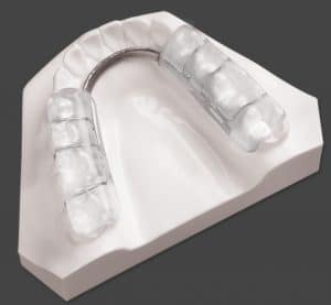 Orthodontic_Splint