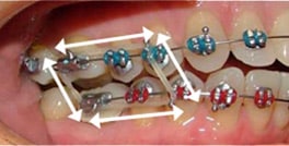 f_boxelastics1.jpg